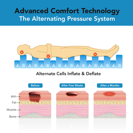Everactiv Anti-Decubitus Air Bed | Anti-Bedsore | Bubble Air Mattress for Patients Bed Sore | Color- Beige