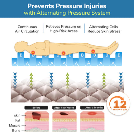 Everactiv Anti-Decubitus Air Bed | Anti-Bedsore | Bubble Air Mattress for Patients Bed Sore | Color- Beige